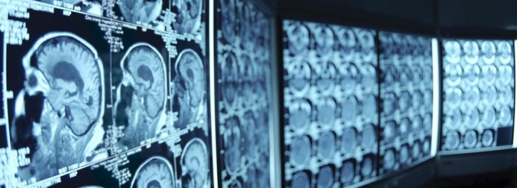 We Need More Neurologists: The Future Demand For Services